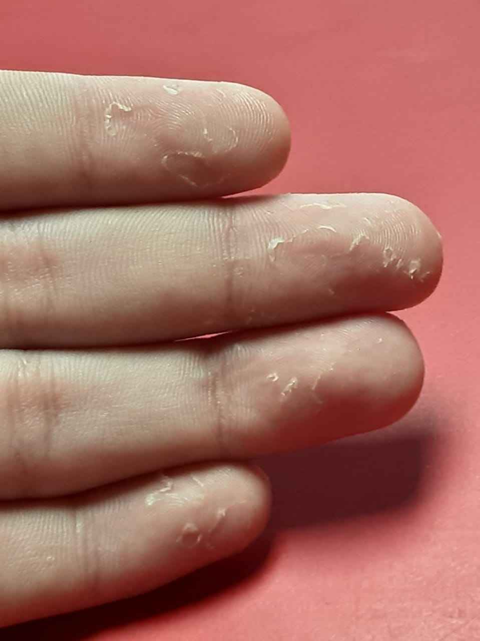 Crema antibacterial Seytu