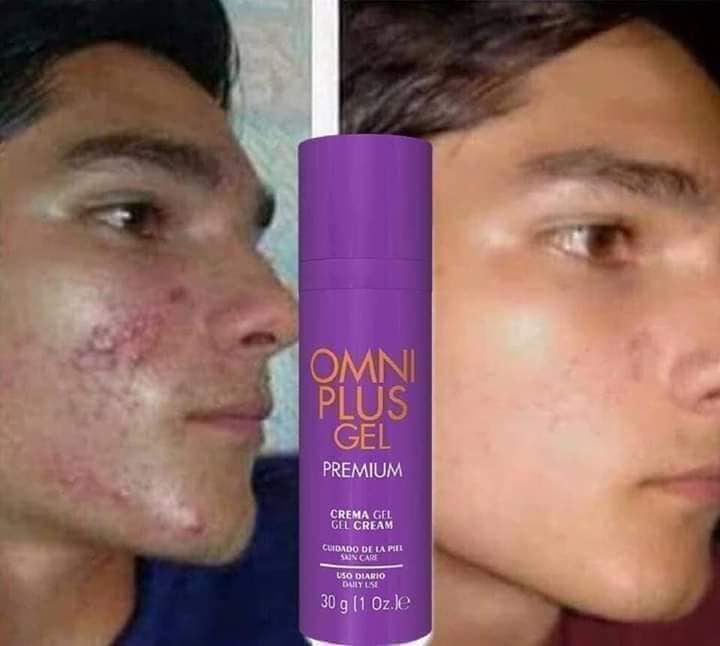 #OMNIPLUS_GEL_PREMIUM

Elimina el acné, secuelas, manchas y Quemaduras!! 

REGEN